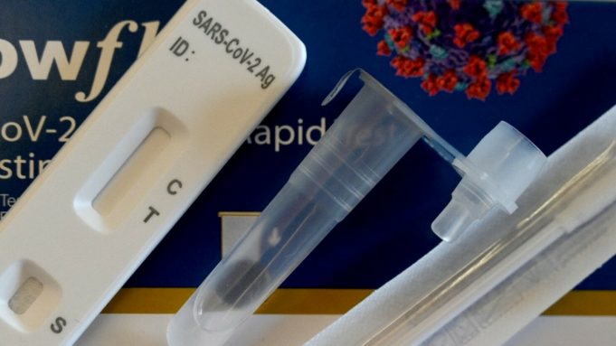 62221943-brzi-antigenski-test-koronavirus